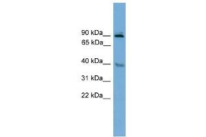 WB Suggested Anti-L3mbtl Antibody Titration: 0. (L3MBTL1 antibody  (Middle Region))