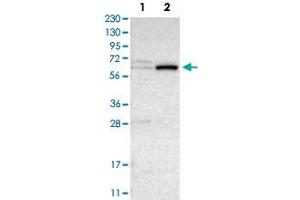 Western Blot analysis of Lane 1: RT-4 and Lane 2: U-251 MG sp cell lysates with CRAT polyclonal antibody .