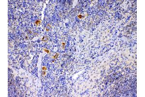 IHC analysis of IL12A using anti-IL12A antibody . (IL12A antibody  (AA 23-215))