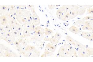 Detection of GSTA4 in Human Cardiac Muscle Tissue using Polyclonal Antibody to Glutathione S Transferase A4 (GSTA4) (GSTA4 antibody  (AA 3-222))