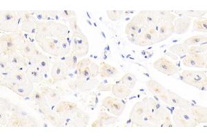 Detection of GSTA4 in Human Cardiac Muscle Tissue using Polyclonal Antibody to Glutathione S Transferase A4 (GSTA4) (GSTA4 antibody  (AA 3-222))