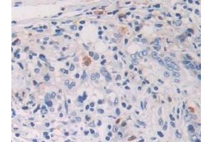 Immunohistochemistry (IHC) image for anti-Hypoxia Inducible Factor 1, alpha Subunit (Basic Helix-Loop-Helix Transcription Factor) (HIF1A) (AA 218-506) antibody (ABIN7439318)