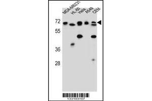 Western blot analysis in MDA-MB231,HL-60,Hela,A549,CEM cell line lysates (35ug/lane). (ASMTL antibody  (AA 231-259))