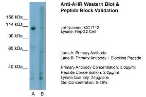 Host:  Rabbit  Target Name:  AHR  Sample Type:  HepG2  Lane A:  Primary Antibody  Lane B:  Primary Antibody + Blocking Peptide  Primary Antibody Concentration:  5. (Aryl Hydrocarbon Receptor antibody  (N-Term))