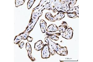 IHC analysis of RING2/RING1B/RNF2 using anti-RING2/RING1B/RNF2 antibody (ABIN7599286). (RNF2 antibody  (AA 1-336))