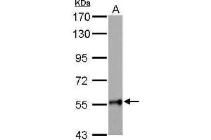 WB Image GALNT2 antibody detects GALNT2 protein by Western blot analysis. (GALNT2 antibody)