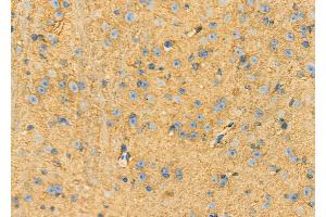 ABIN6262957 and ABIN6273262 at 1/100 staining Mouse brain tissue by IHC-P. (DHX58 antibody  (Internal Region))