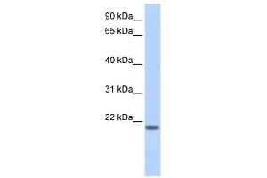 FLJ33706 antibody used at 5 ug/ml to detect target protein. (FLJ33706 (C-Term) antibody)