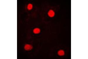 Immunofluorescent analysis of NICE4 staining in MCF7 cells. (UBAP2L antibody  (Center))