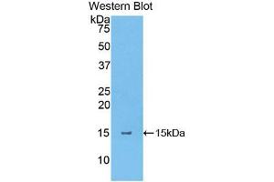 Western blot analysis of the recombinant protein. (Thymic Stromal Lymphopoietin antibody  (AA 75-196))