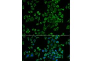 Immunofluorescence analysis of U2OS cells using P2RY2 Polyclonal Antibody (P2RY2 antibody)