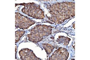 IHC analysis of SDF2L1 using anti-SDF2L1 antibody (ABIN7601111).