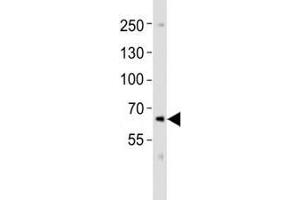 Western blot analysis of lysate from SK-N-MC cell line using PCSK9 antibody at 1:1000. (PCSK9 antibody  (C-Term))