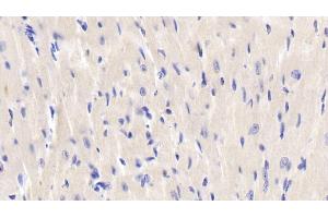 Detection of JNK1 in Mouse Cardiac Muscle Tissue using Polyclonal Antibody to c-Jun N-terminal Kinase 1 (JNK1) (C-Jun N-Terminal Kinases (AA 138-382) antibody)