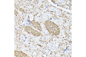 Immunohistochemistry of paraffin-embedded human brain using APP Rabbit mAb (ABIN7265575) at dilution of 1:100 (40x lens). (APP antibody)