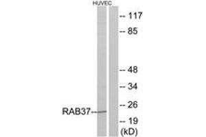 Western blot analysis of extracts from HuvEc cells, using RAB37 Antibody.