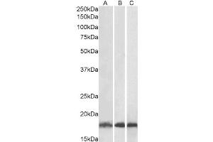Western Blotting (WB) image for anti-Ubiquitin-Conjugating Enzyme E2L 3 (UBE2L3) antibody (ABIN5894613) (UBE2L3 antibody)