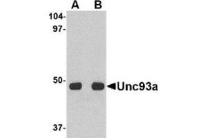 Western blot analysis of Unc93a in HeLa cell lysate with this product at (A) 0. (UNC93A antibody  (C-Term))