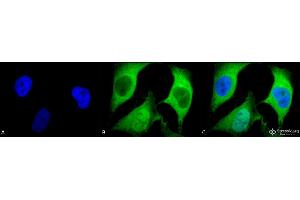 Immunocytochemistry/Immunofluorescence analysis using Mouse Anti-Ubiquitin Monoclonal Antibody, Clone 5B9-B3 .