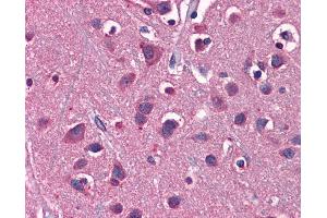 Immunohistochemistry (IHC) image for anti-Solute Carrier Family 1 (Glial High Affinity Glutamate Transporter), Member 2 (SLC1A2) (N-Term) antibody (ABIN2778148) (SLC1A2 antibody  (N-Term))