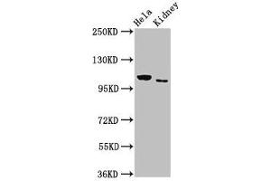Western Blot Positive WB detected in: Hela whole cell lysate, Rat kidney tissue All lanes: NEK9 antibody at 3 μg/mL Secondary Goat polyclonal to rabbit IgG at 1/50000 dilution Predicted band size: 108 kDa Observed band size: 108 kDa (NEK9 antibody  (AA 821-979))