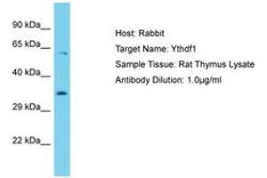 Image no. 1 for anti-YTH Domain Family, Member 1 (YTHDF1) (AA 127-176) antibody (ABIN6750377) (YTHDF1 antibody  (AA 127-176))