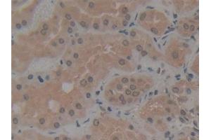 Immunohistochemistry (IHC) image for anti-Nucleoporin 210kDa (NUP210) (AA 1288-1449) antibody (ABIN7442474)