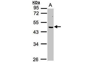 Image no. 1 for anti-Excision Repair Cross-Complementing Rodent Repair Deficiency, Complementation Group 8 (ERCC8) (AA 1-164) antibody (ABIN467383) (ERCC8 antibody  (AA 1-164))