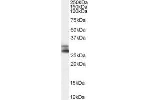 Western Blotting (WB) image for anti-ADP-Ribosylation-Like Factor 6 Interacting Protein 4 (ARL6IP4) (Middle Region) antibody (ABIN2790727) (ARL6IP4 antibody  (Middle Region))
