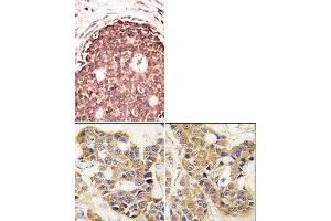 Image no. 2 for anti-Matrix Metallopeptidase 9 (Gelatinase B, 92kDa Gelatinase, 92kDa Type IV Collagenase) (MMP9) (C-Term) antibody (ABIN358703) (MMP 9 antibody  (C-Term))