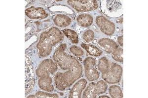 Immunohistochemical staining of human kidney with FAM135A polyclonal antibody  shows moderate cytoplasmic positivity in tubular cells. (FAM135A antibody)