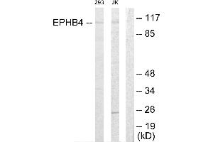 Western blot analysis of extracts from 293 cells and Jurkat cells, using EPHB4 antibody. (EPH Receptor B4 antibody  (Internal Region))