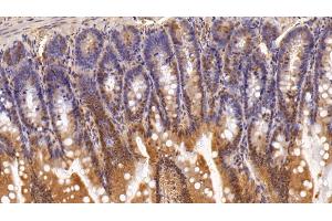 Detection of ADRM1 in Rat Small intestine Tissue using Polyclonal Antibody to Adhesion Regulating Molecule 1 (ADRM1) (ADRM1 antibody  (AA 2-407))
