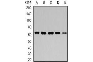Western blot analysis of GPI expression in MCF7 (A), Hela (B), mouse kidney (C), mouse heart (D), rat brain (E) whole cell lysates. (GPI antibody)