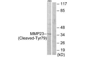 Western blot analysis of extracts from 293 cells, treated with etoposide (25uM, 1hour), using MMP23 (Cleaved-Tyr79) antibody.