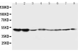 Lane 8: COLO320 Cell Lysate (HTR2A antibody  (C-Term))