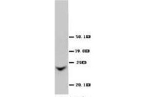 Western blot analysis of Rat liver sections using Connexin 26 antibody (GJB2 antibody  (Middle Region))