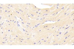 Detection of ERb in Mouse Cardiac Muscle Tissue using Polyclonal Antibody to Estrogen Receptor Beta (ERb) (ESR2 antibody  (AA 46-530))