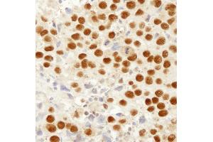 Immunohistochemistry (IHC) image for anti-Mismatch Repair Protein 2 (MSH2) (C-Term) antibody (ABIN7448673) (MSH2 antibody  (C-Term))