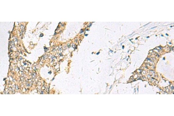 SPACA1 antibody
