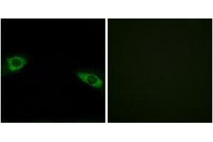 Immunofluorescence analysis of HuvEc cells, using RPS4Y1 Antibody. (RPS4Y1 antibody  (AA 214-263))