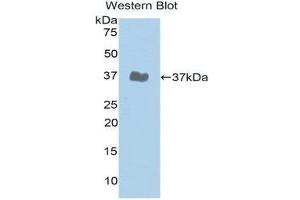 Western Blotting (WB) image for anti-Janus Kinase 2 (JAK2) (AA 508-800) antibody (ABIN1176451) (JAK2 antibody  (AA 508-800))