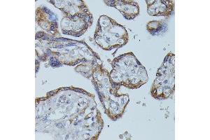 Immunohistochemistry (IHC) image for anti-Fc Fragment of IgG, High Affinity Ib, Receptor (CD64) (FCGR1B) antibody (ABIN7267161)