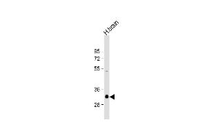 Anti-NMNAT1 Antibody (C-Term) at 1:2000 dilution + human brain lysate Lysates/proteins at 20 μg per lane. (NMNAT1 antibody  (AA 200-232))