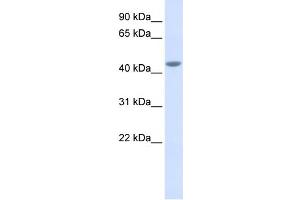 WB Suggested Anti-IL11RA Antibody Titration:  0. (IL11RA antibody  (Middle Region))