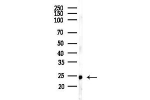 anti-Paired Related Homeobox 2 (PRRX2) (Internal Region) antibody