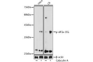 Western blot analysis of extracts of various cell lines, using Phospho-eIF2α-S51 antibody (ABIN3020189, ABIN3020190, ABIN3020191 and ABIN1681553) at 1:1000 dilution. (EIF2S1 antibody  (pSer51))