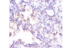 Immunohistochemistry of paraffin-embedded human prostate using CLU / Clusterin antibody at dilution of 1:100. (Clusterin antibody  (FITC))