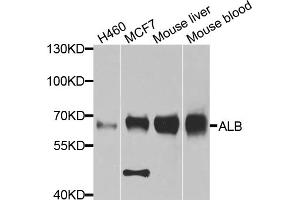 Western blot analysis of extracts of various cell lines, using ALB antibody (ABIN5969844) at 1/1000 dilution. (Albumin antibody)