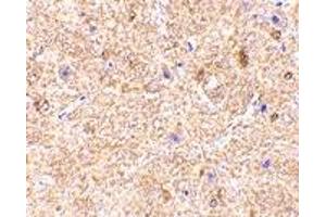 Immunohistochemistry (IHC) image for anti-Mitochondrial Antiviral Signaling Protein (MAVS) (Middle Region) antibody (ABIN1031160) (MAVS antibody  (Middle Region))